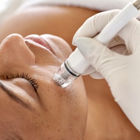 Hydrodermabrasion facial treatment in Los Angeles at EstheticsLA